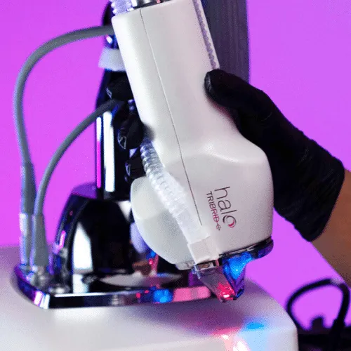 TRIBRID laser skin treatment in action